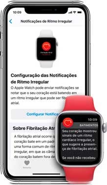 Apple البرازيل تؤكد وصول ECG والضربات غير المنتظمة في التحديث القادم 3