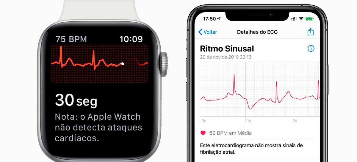 Apple Brasil confirma chegada do ECG e batidas irregulares no próximo update