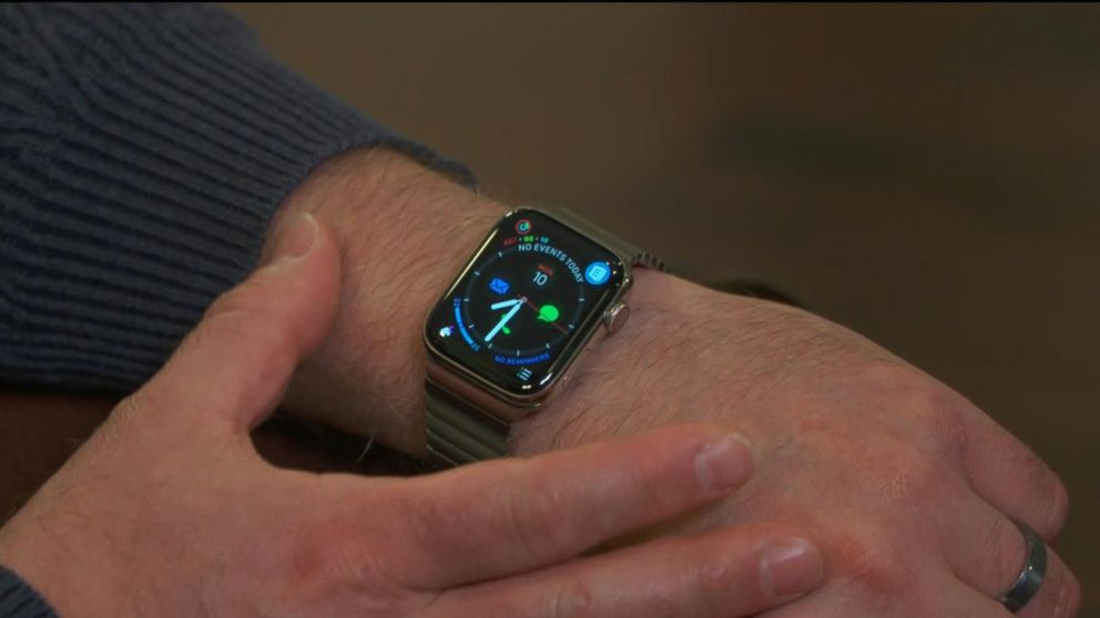 كيفية تغيير الوقت Apple Watch بطرق سهلة