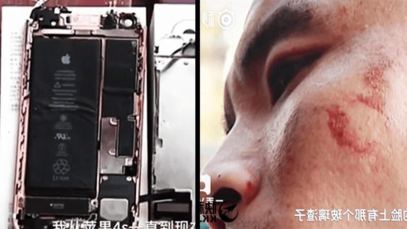 iPhone 7 ينفجر على وجه الرجل أثناء تسجيل الفيديو 1