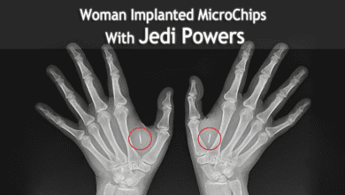 This Woman Implanted MicroChips With Jedi Powers In Her Hand