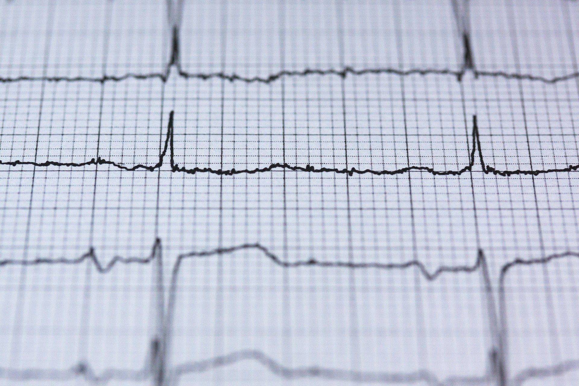 في المستقبل ، يمكن لنبضات القلب أن تحل محل بصمات الأصابع في التعرف على القياسات الحيوية 1